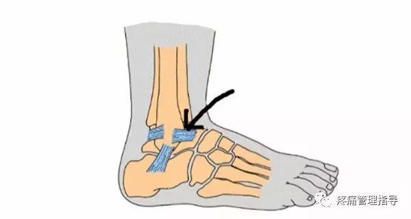 nba崴脚后怎么恢复的 NBA球星脚踝扭伤的处理方法(11)