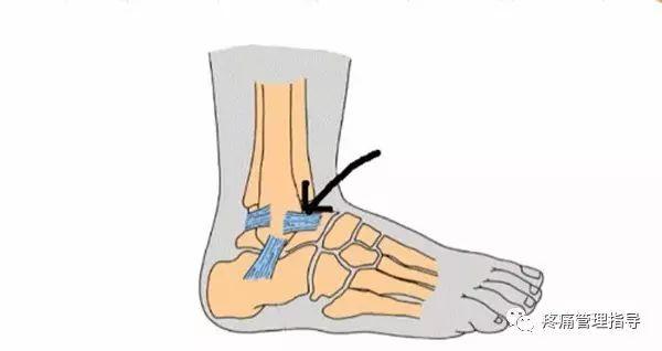 nba崴脚后怎么恢复的 NBA球星脚踝扭伤的处理方法(13)