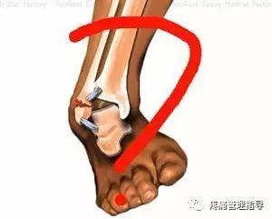 nba崴脚后怎么恢复的 NBA球星脚踝扭伤的处理方法(48)