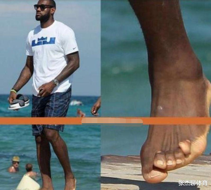 NBA球星成功有多不易？老詹脚趾全变形，马里昂手指永久弯折(2)