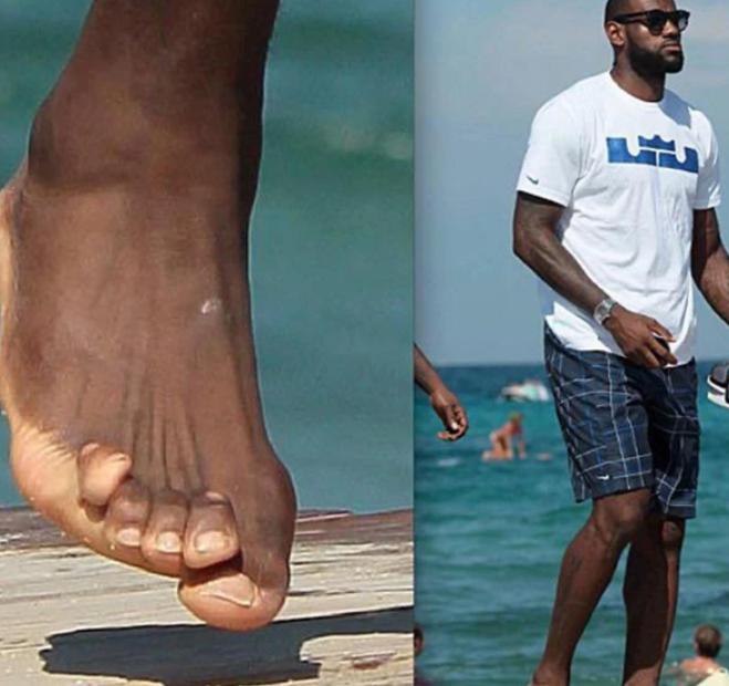 看了姚明脚踝 ，科比手指，你就相信NBA球星是透支身体赚钱(4)