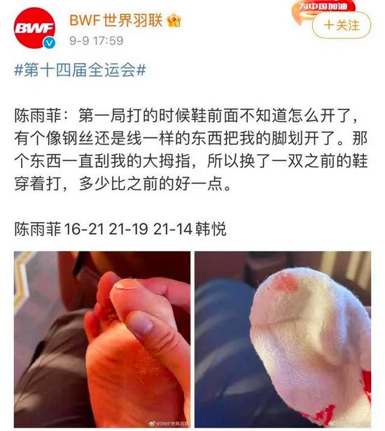 陈雨菲在全运会赛场大脚趾被球鞋划伤 网友心疼